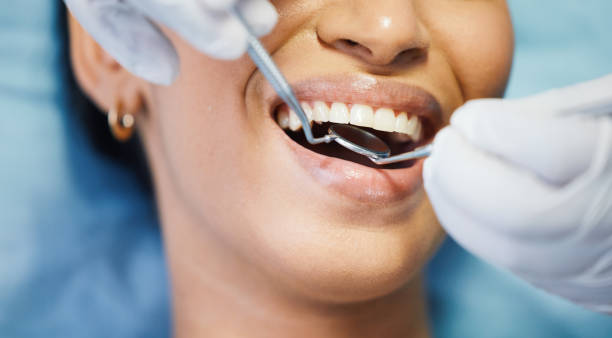 Best Urgent Care for Lost Fillings or Crowns in Pine Lakes, FL